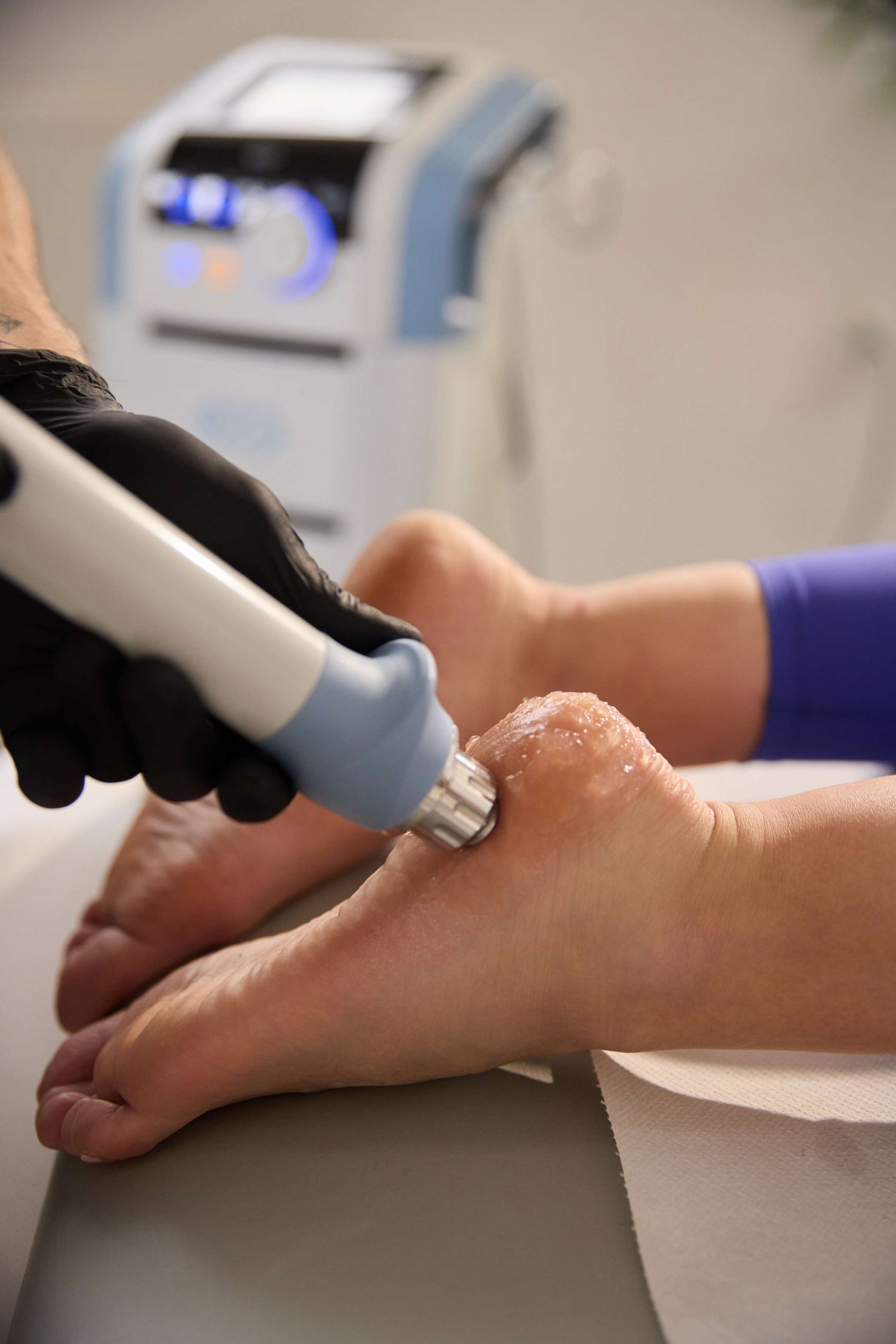 Fizioterapie-shockwave Optimize Body Center