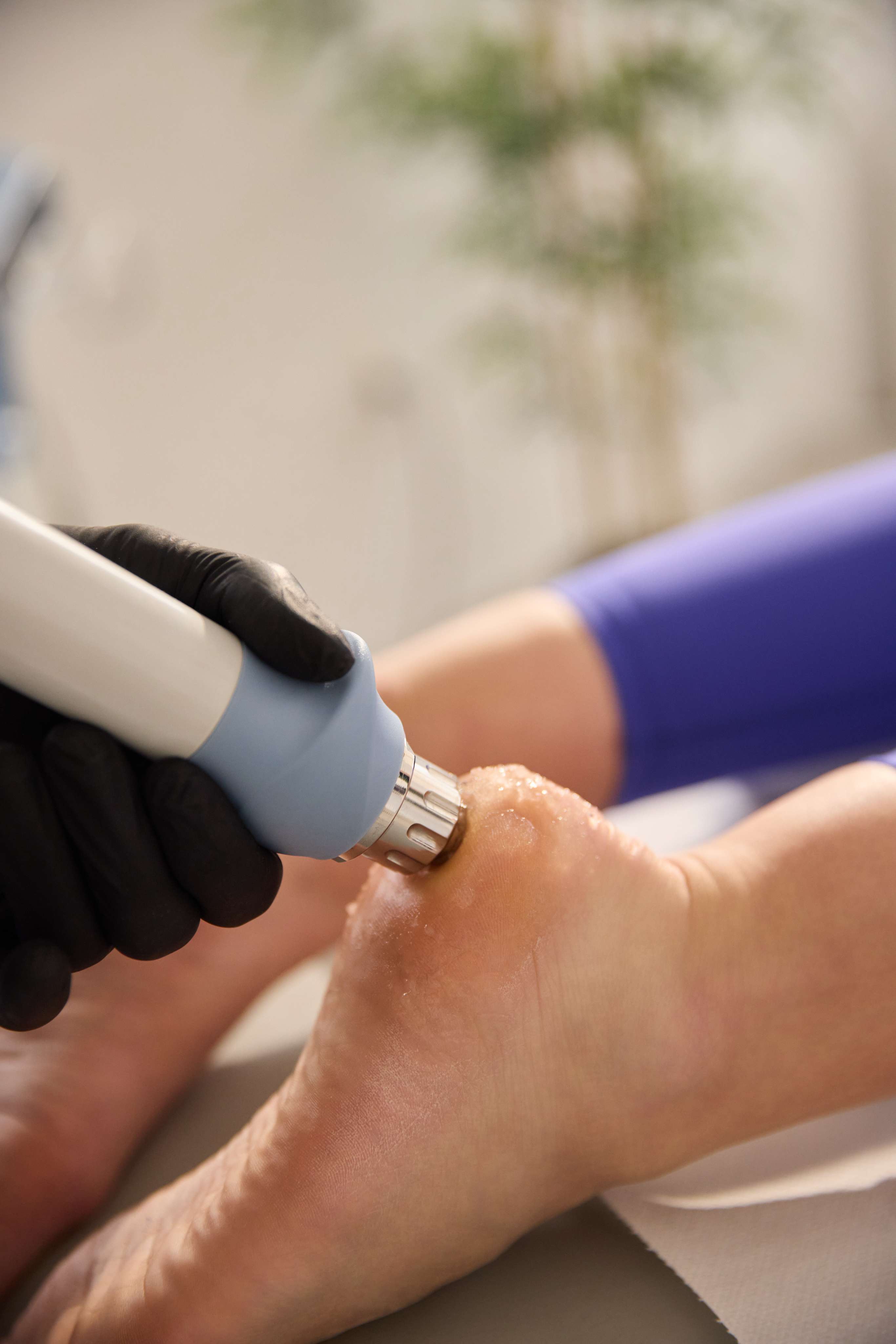 Fizioterapie-shockwave Optimize Body Center