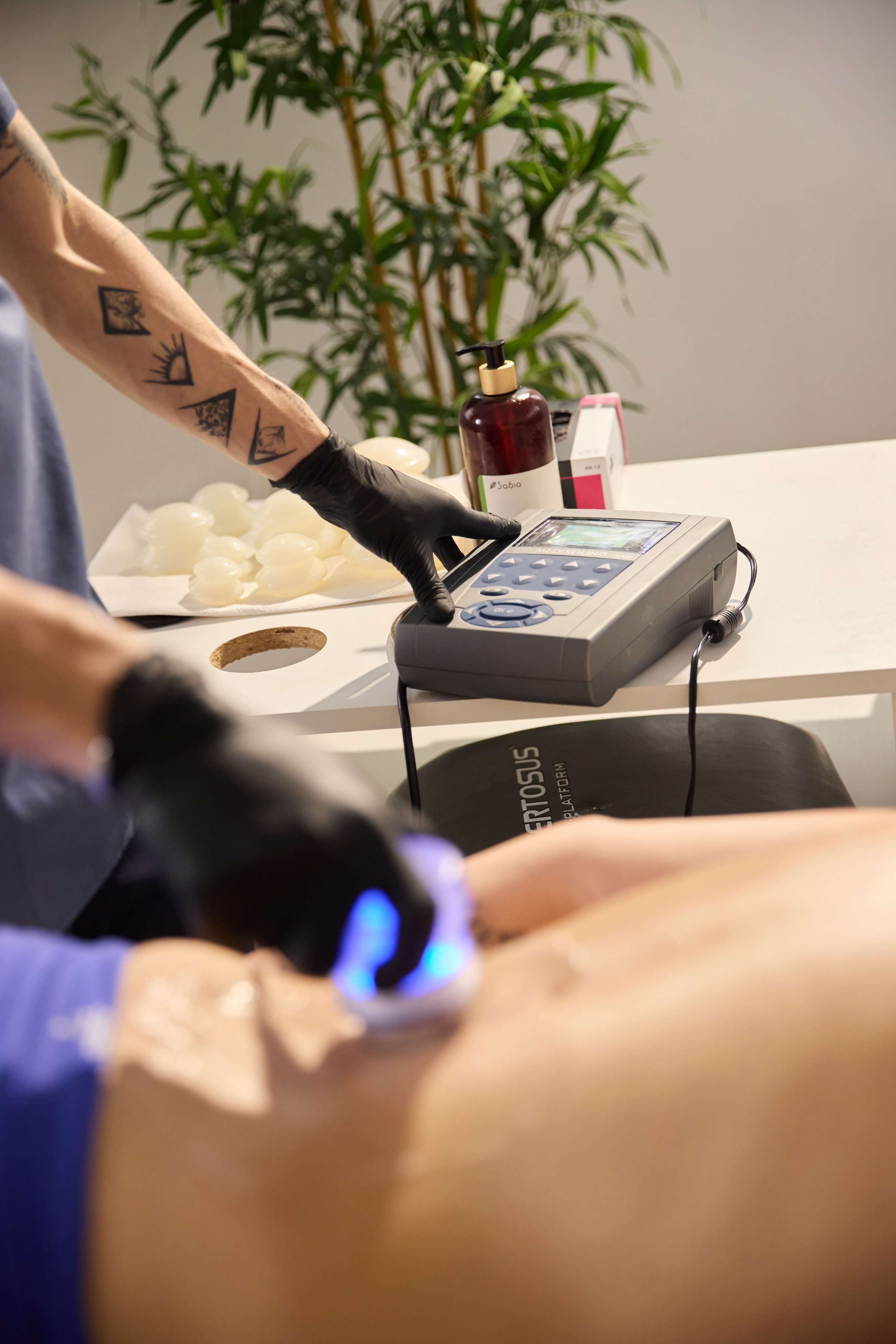 Terapie Laser la Optimize Body Center