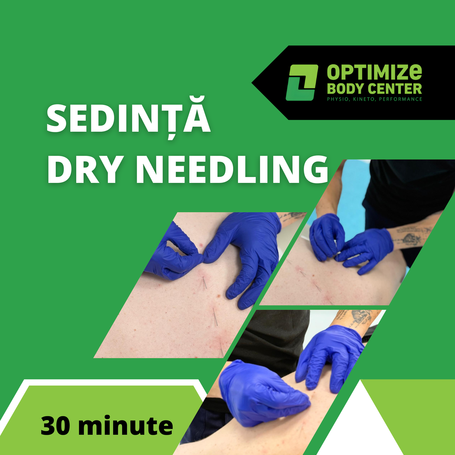 Ședință Dry Needling