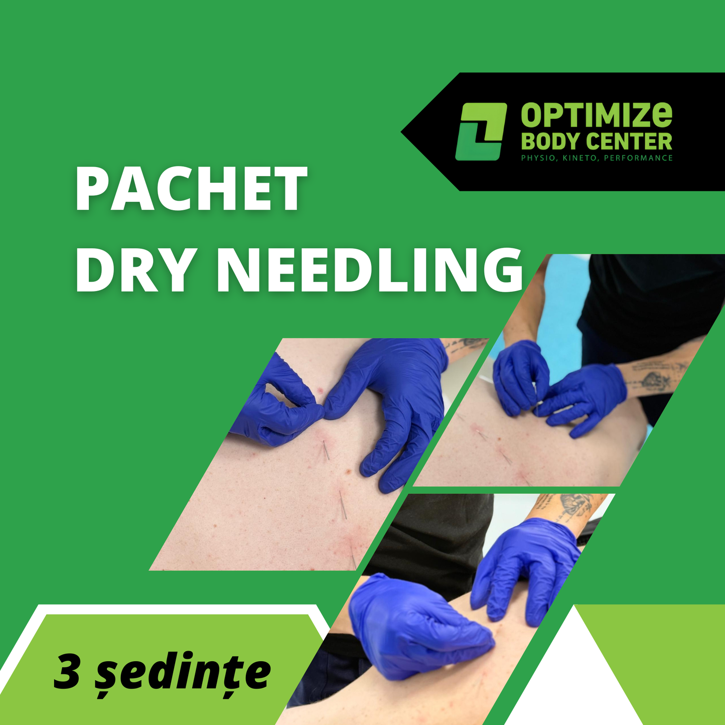 Pachet Dry Needling